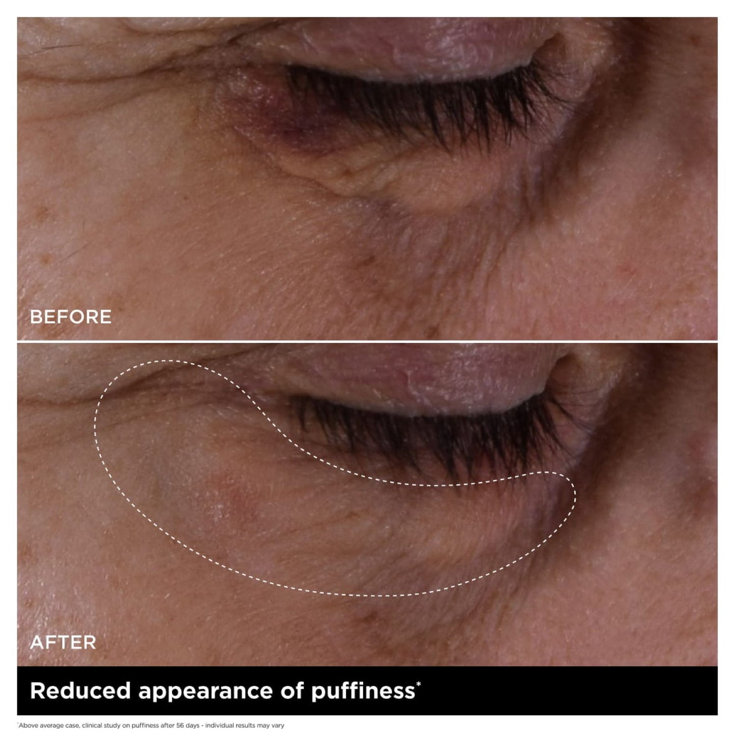 Double Serum Eye New