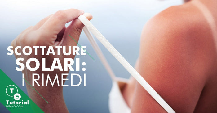 Scottature solari: i rimedi