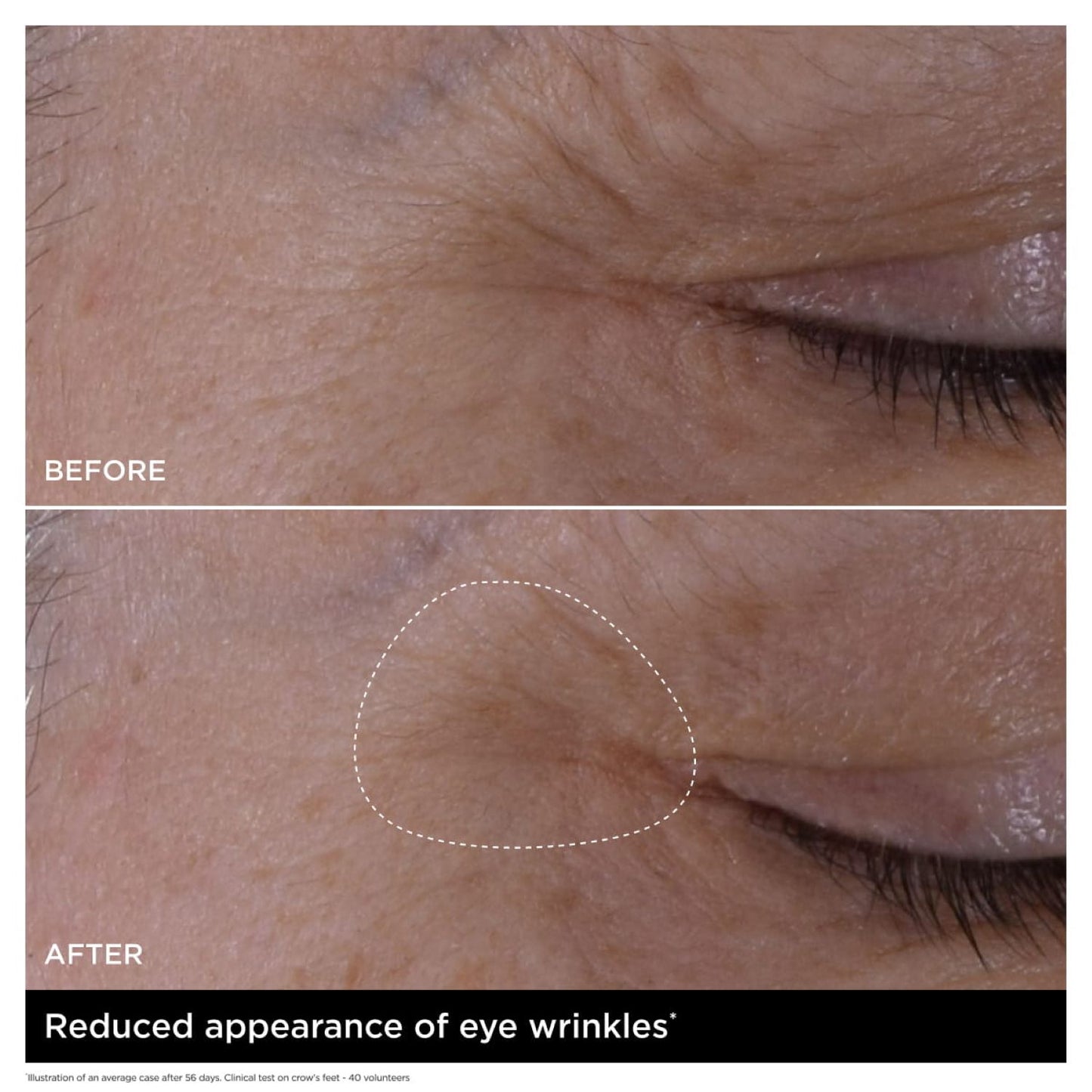 Double Serum Eye New