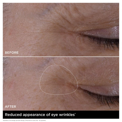 Double Serum Eye New