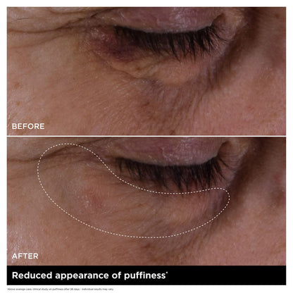 Double Serum Eye New