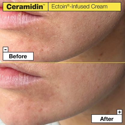 Dr.Jart+ Ceramidin Ectoin-Infused Cream